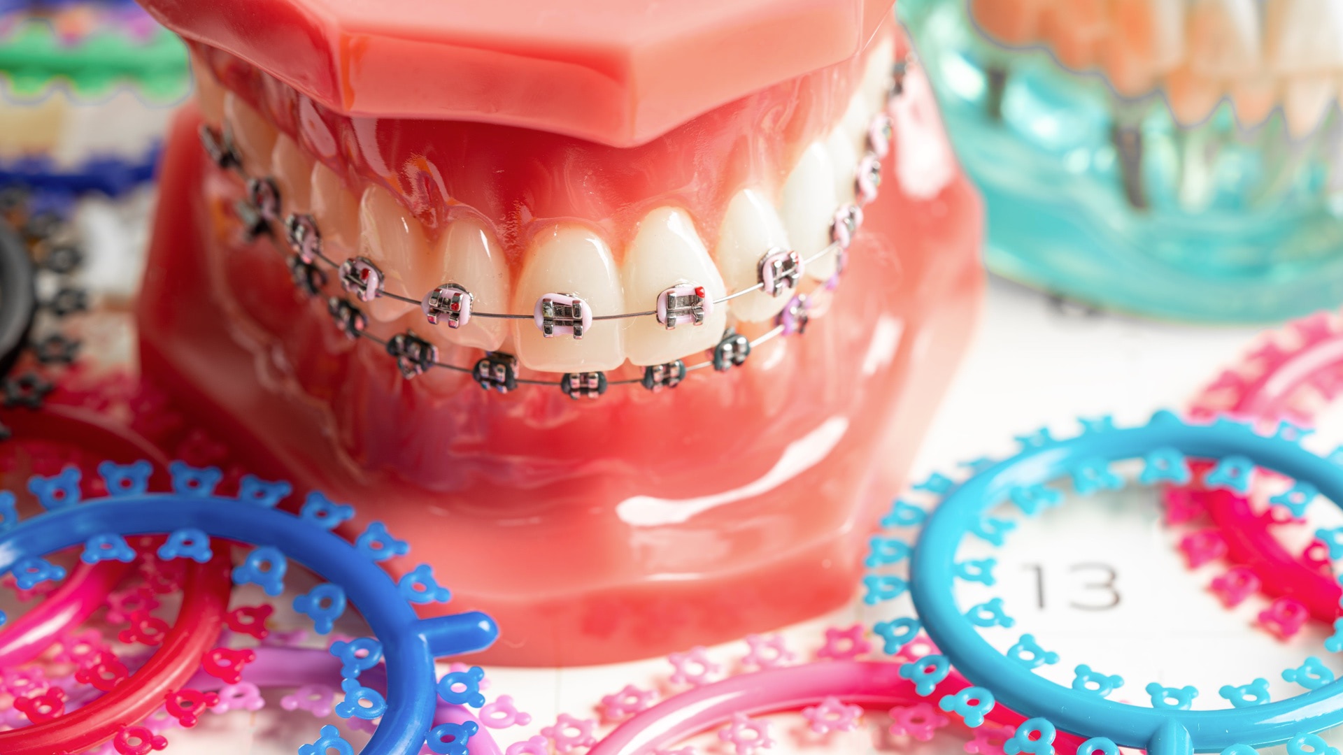 Orthodontics Image