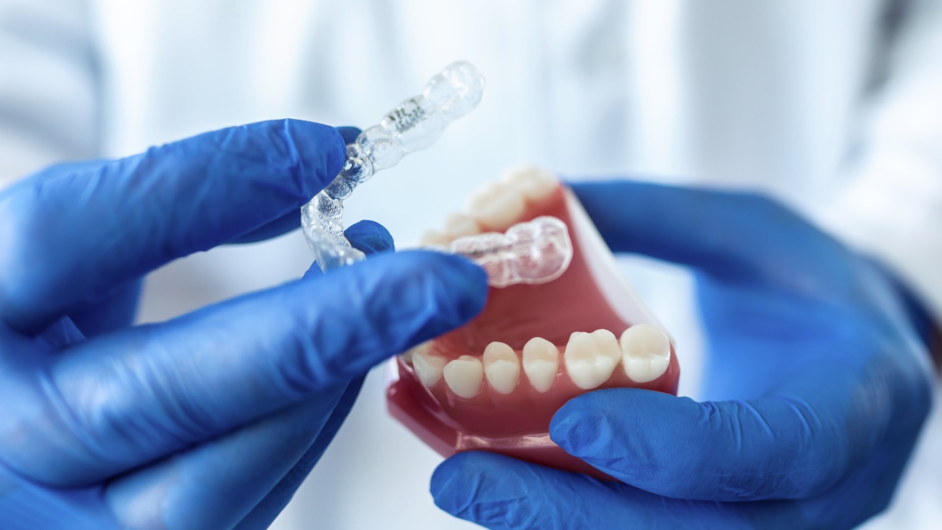 Şeffaf Plak (Invisalign) Tedavisinde Dikkat Edilmesi Gerekenler - Görsel