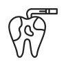 Dental Bonding